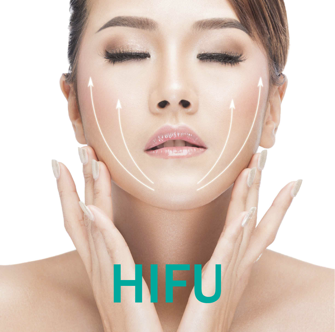 HIFU FACIAL LUNA