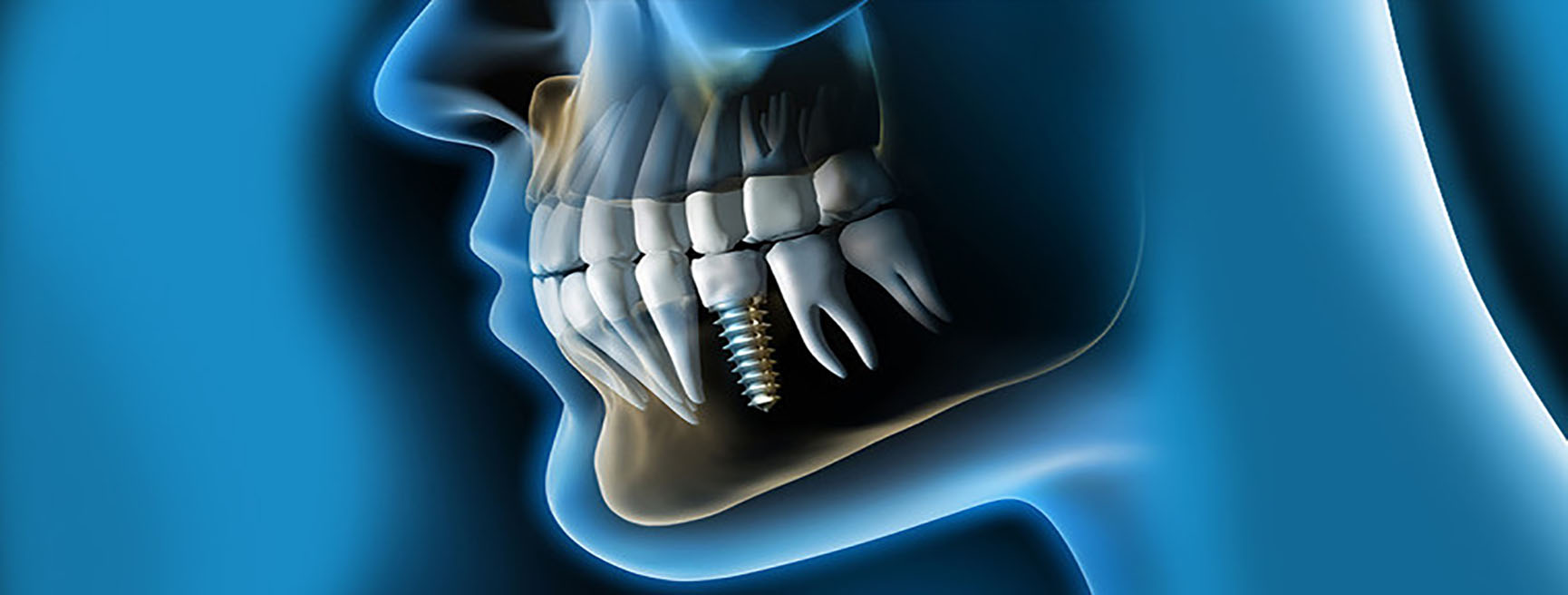 cirugia dental
