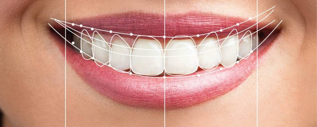 estetica dental