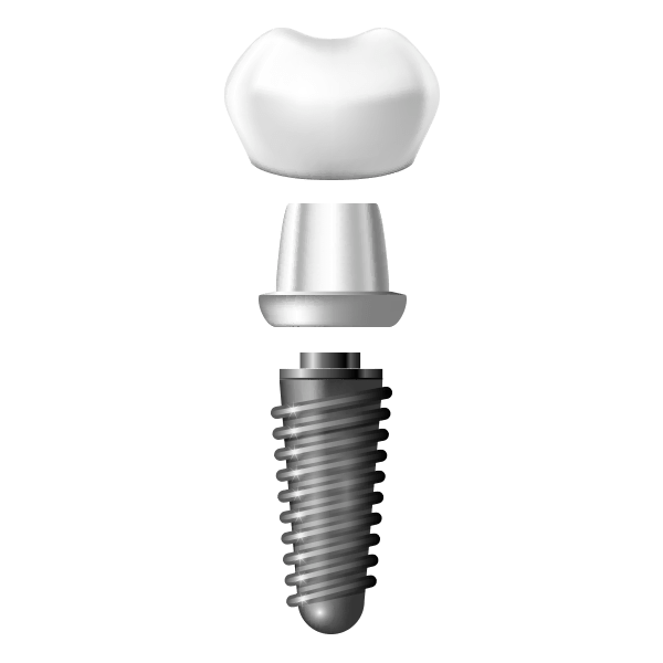 implanteS